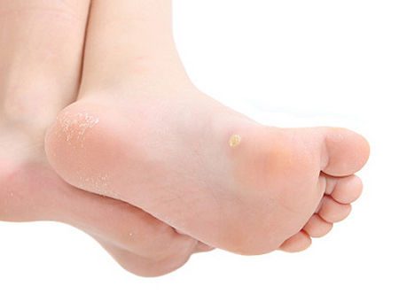 4大恼人的儿童传染性健康问题-安全技术质量