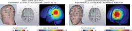研究发现脑电刺激能改善老年人的记忆力